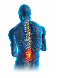 Back Pain